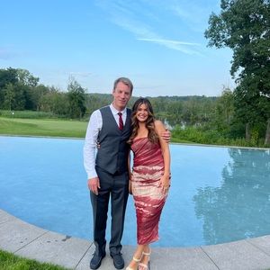 Zara TieDye Tulle Dress